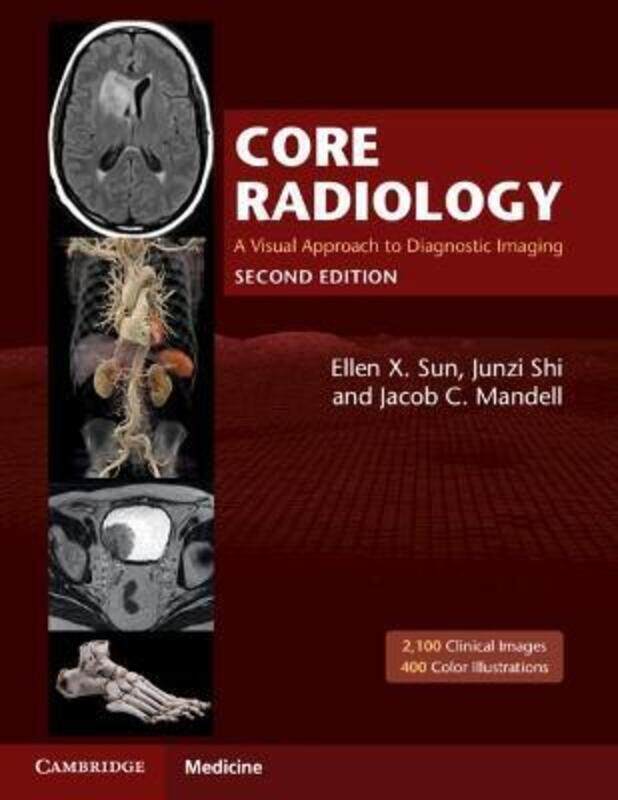 

Core Radiology: A Visual Approach to Diagnostic Imaging.paperback,By :Sun, Ellen X. - Shi, Junzi - Mandell, Jacob C.