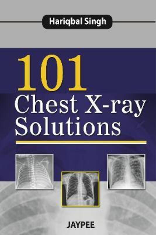 101 Chest X-Ray Solutions,Paperback,BySingh, Hariqbal