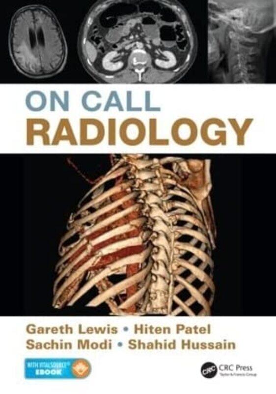 

On Call Radiology by Stormie Omartian-Paperback