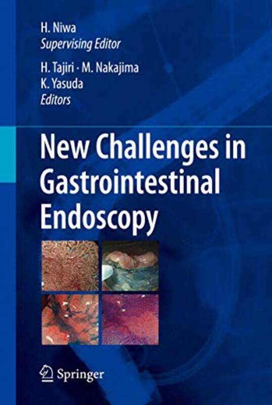 

New Challenges in Gastrointestinal Endoscopy by Meagan Stevenson-Paperback