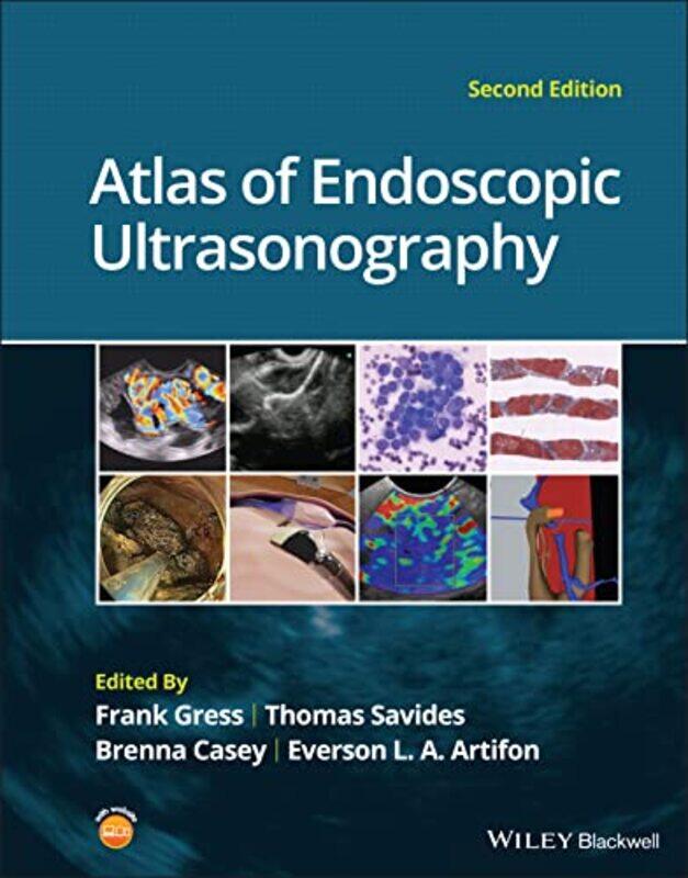 

Atlas of Endoscopic Ultrasonography by Dr Alex University of Leeds UK DingDr Michelle University of Leeds UK Evans-Hardcover