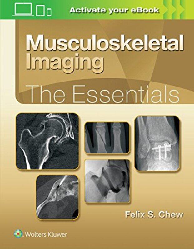 

Musculoskeletal Imaging The Essentials by Hannah Koelmeyer-Hardcover