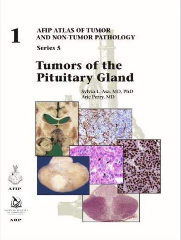 

Tumors Of The Pituitary Gland by Sylvia L AsaArie Perry-Hardcover