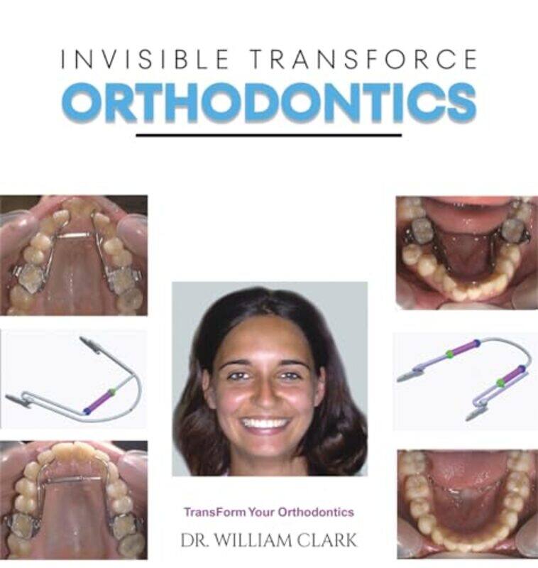 

Invisible Transforce Orthodontics by Dr William Clark-Hardcover