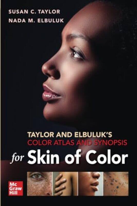 

Taylor and Elbuluks Color Atlas and Synopsis for Skin of Color by Anthony Moore-Paperback