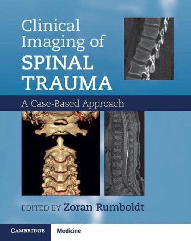 

Clinical Imaging of Spinal Trauma by Dan University of Copenhagen Denmark Zahavi-Paperback