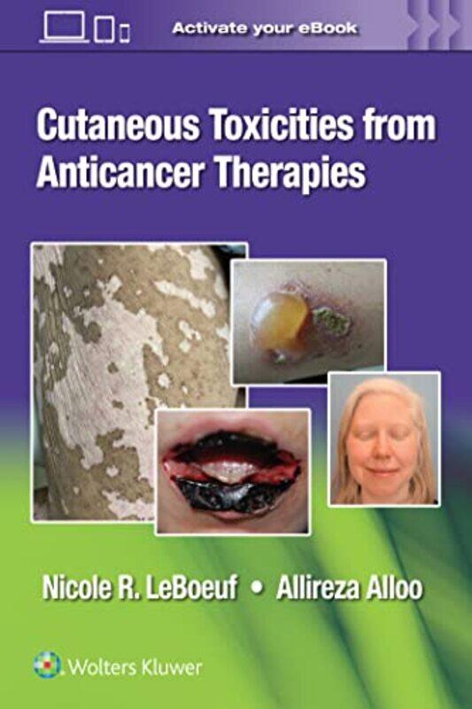 

Cutaneous Toxicities from Anticancer Therapies by D University of Arts London UK Tran-Paperback