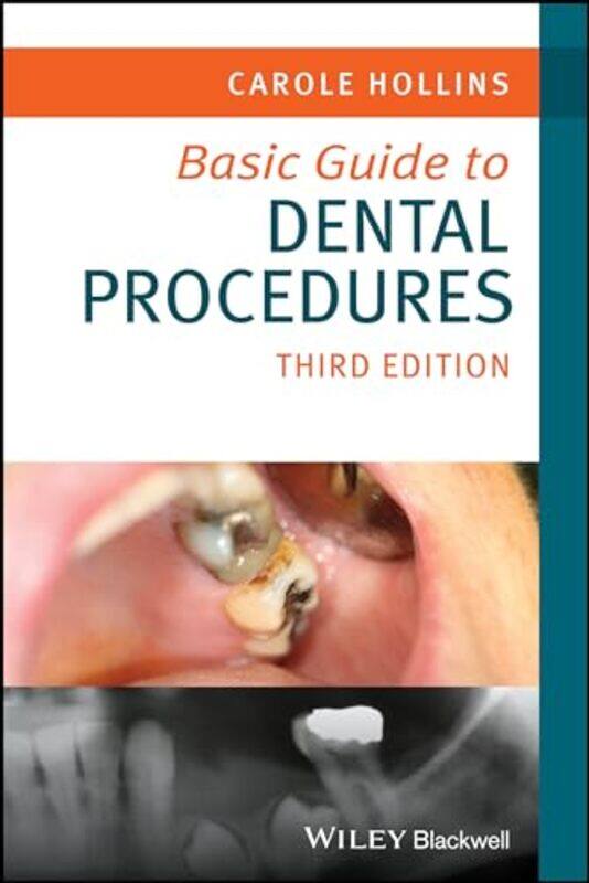 

Basic Guide To Dental Procedures by Carole (British Dental Association) Hollins-Paperback