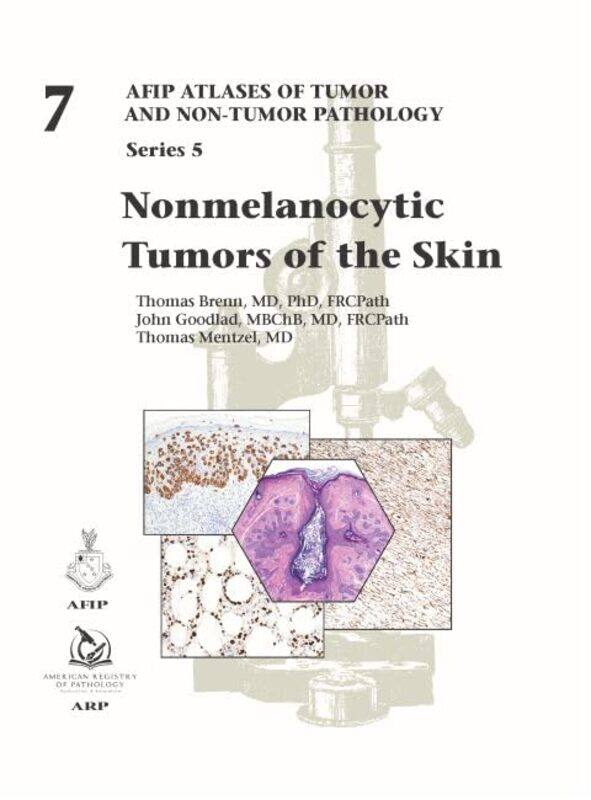 

Nonmelanocytic Tumors of the Skin by Dorothy Richmond-Hardcover