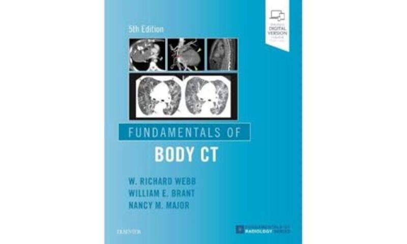 

Fundamentals of Body CT by Stephen EdgellEdward Granter-Paperback