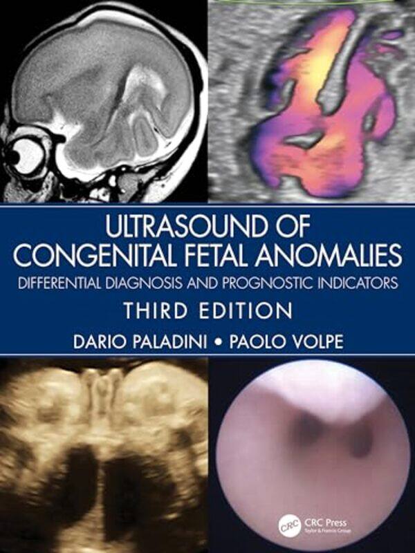 

Ultrasound Of Congenital Fetal Anomalies Differential Diagnosis And Prognostic Indicators By Paladini, Dario - Volpe, Paolo - Hardcover