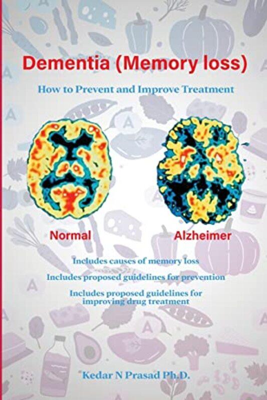 

Dementia Memory Loss by Linda Georgia State University Grant-Paperback