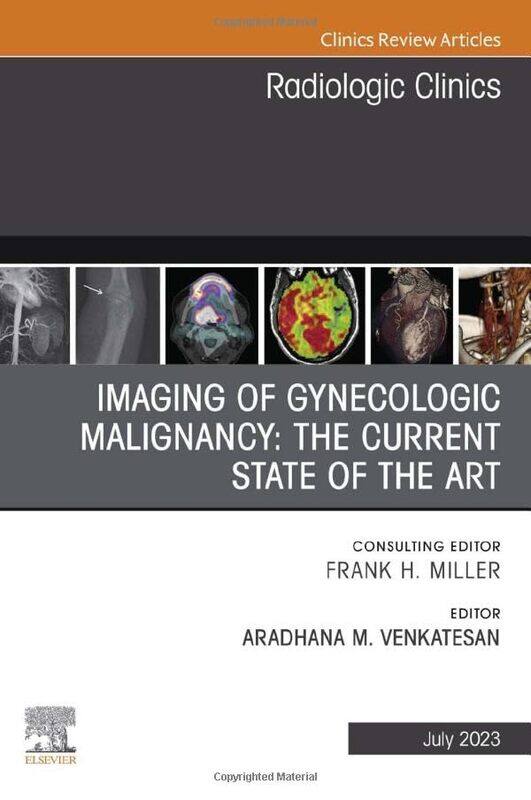 

Imaging of Gynecologic Malignancy The Current State of the Art An Issue of Radiologic Clinics of North America by Sri Swami Satchidananda-Hardcover