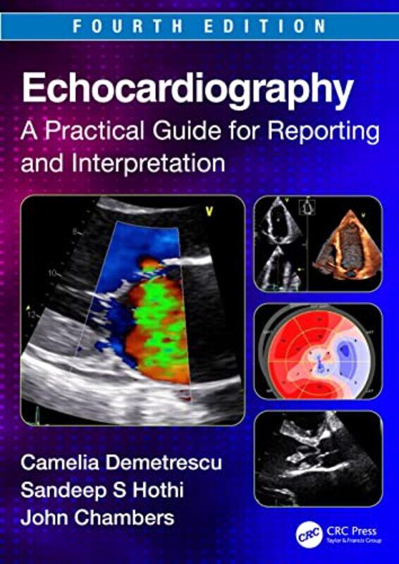 

Echocardiography by Franz Franz Lanzinger Lanzinger-Paperback