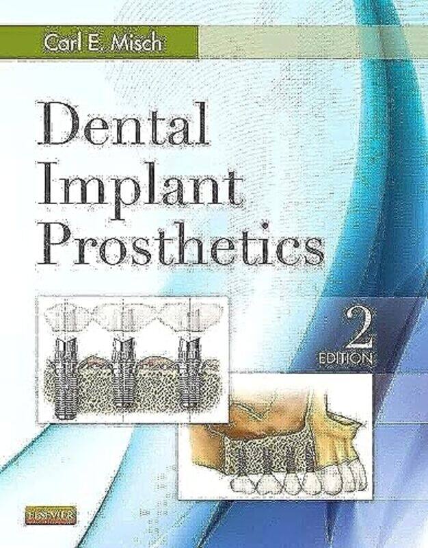 

Dental Implant Prosthetics by Carl E Misch-Hardcover