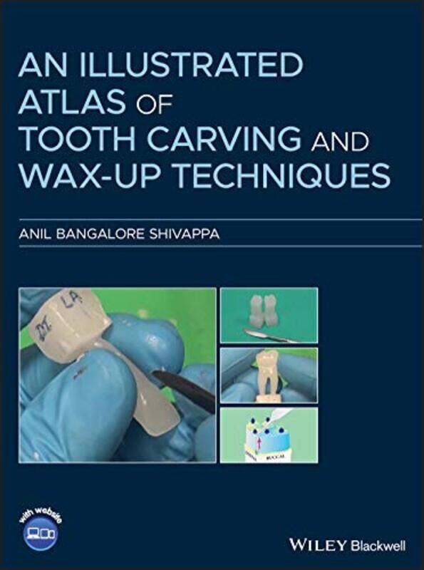 

An Illustrated Atlas of Tooth Carving and Wax-Up Techniques,Hardcover by Bangalore Shiva, A