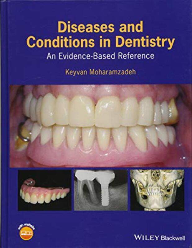 

Diseases And Conditions In Dentistry An Evidencebased Reference By Moharamzadeh, Keyvan Hardcover