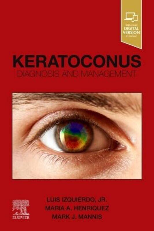 

Keratoconus by Christopher L Webber-Paperback
