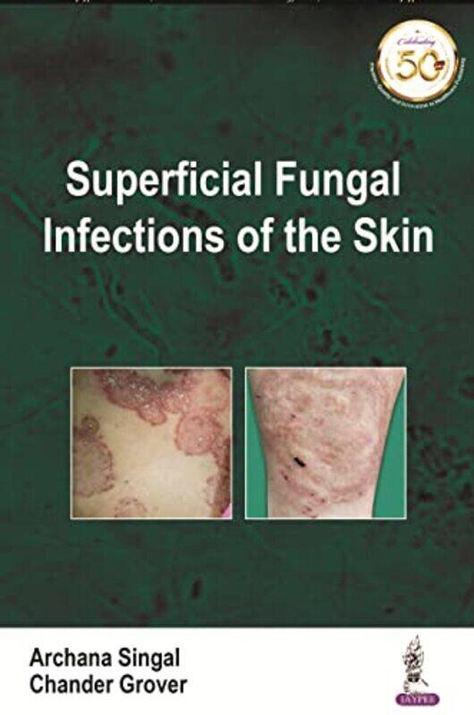 

Superficial Fungal Infections Of The Skin By Singal, Archana - Grover, Chander - Paperback