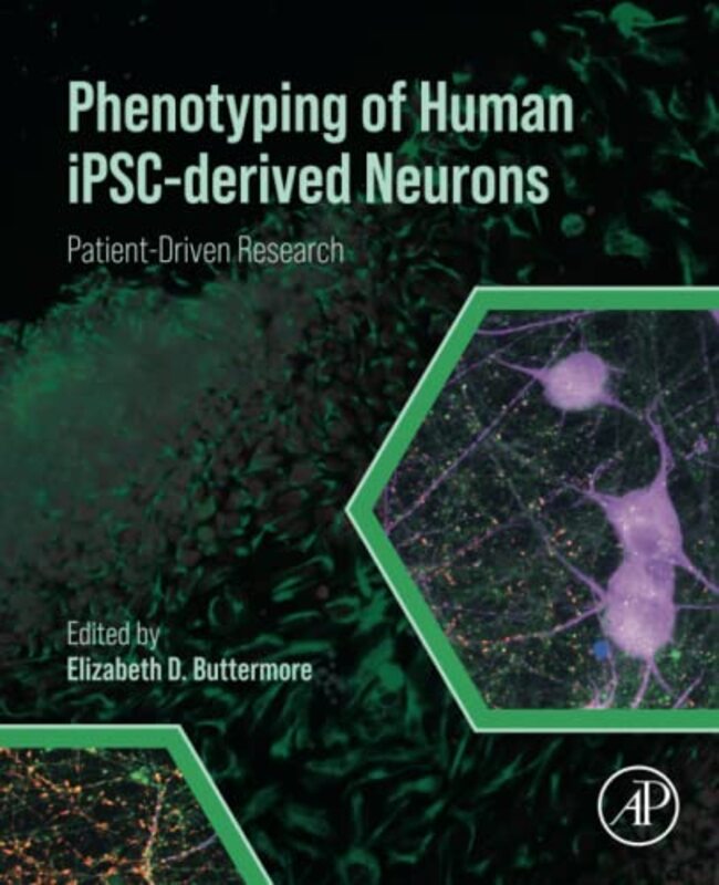 

Phenotyping Of Human Ipscderived Neurons by Elizabeth D (Assistant Director for the Human Neuron Core at Boston Children’s Hospital (BCH), Phenotyping