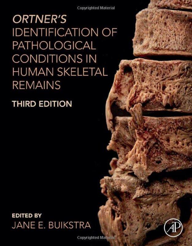 

Ortners Identification of Pathological Conditions in Human Skeletal Remains by Mary Soderstrom-Hardcover