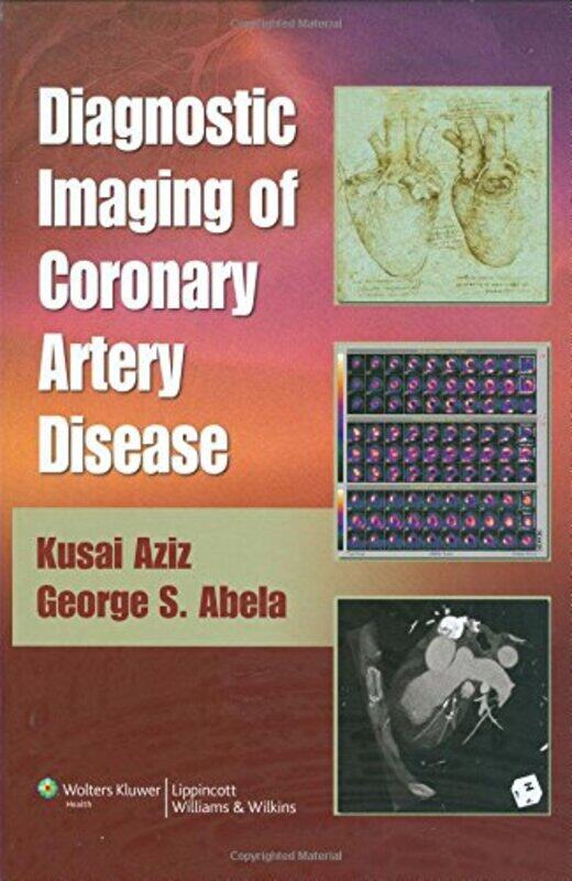 

Diagnostic Imaging of Coronary Artery Disease by Roger York University Toronto Keil-Hardcover