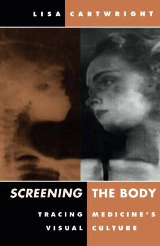 

Screening The Body by Lisa Cartwright-Paperback