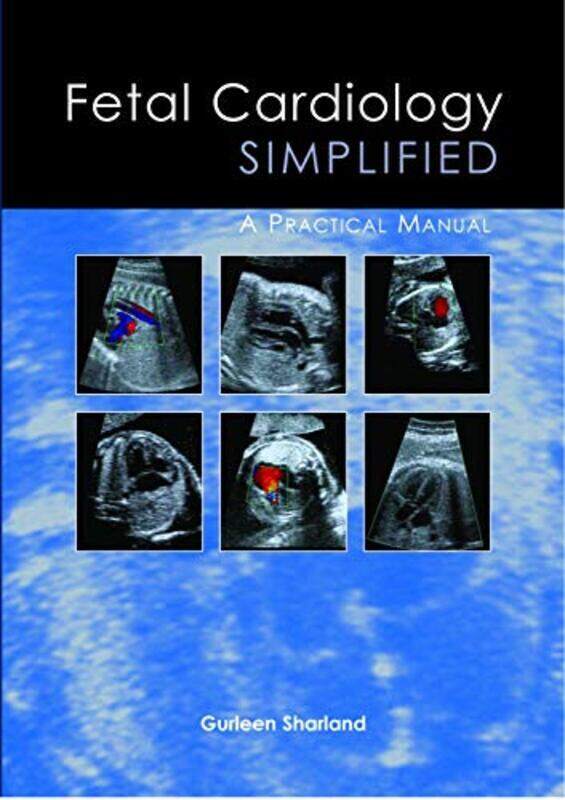 

Fetal Cardiology Simplified A Practical Manual Sharland, Gurleen Paperback