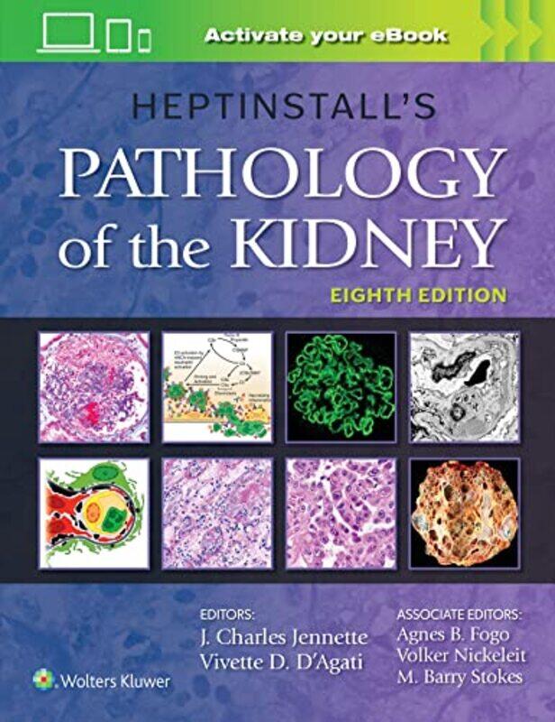 

Heptinstalls Pathology of the Kidney by Sophie GilesAngela Hewitt-Hardcover