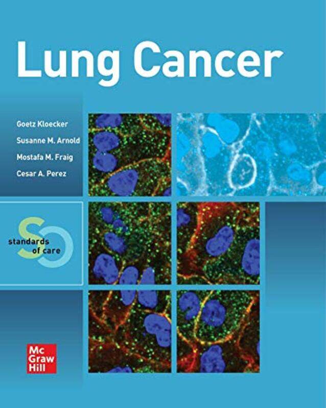 

Lung Cancer Standards of Care by Doggy Todays Doggy-Paperback