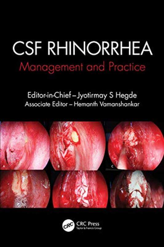 

CSF Rhinorrhoea by Andrea LeiningerBruce LeiningerKen Gross-Paperback
