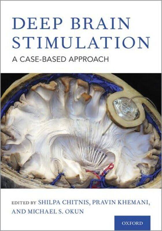 

Deep Brain Stimulation by Jesper LarssonEva-Lotta Paivio Sjaunja-Hardcover