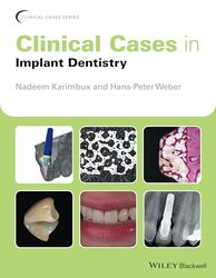 Clinical Cases in Implant Dentistry by Karimbux, Nadeem (Tufts University School of Dental Medicine, Boston, Massachusetts, USA) - Weber, H Paperback