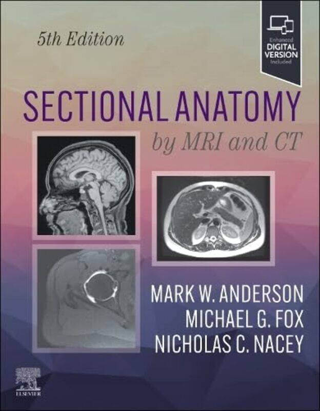 

Sectional Anatomy By Mri And Ct By Anderson, Mark W. (Harrison Distinguished Teaching Professor Of Radiology; Chief, Musculoskeletal Im - Hardcover