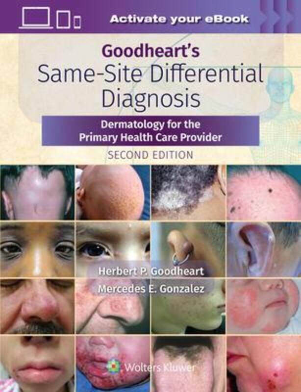 

Goodheart's Same-Site Differential Diagnosis.paperback,By :Herbert Goodheart