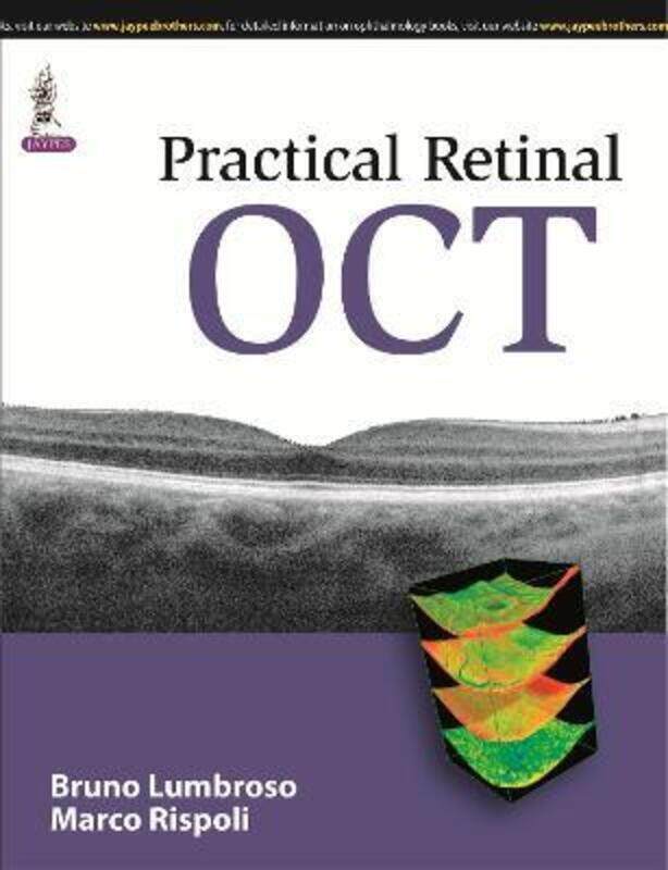 

Practical Retinal OCT,Paperback,ByLumbroso, Bruno - Rispoli, Marco