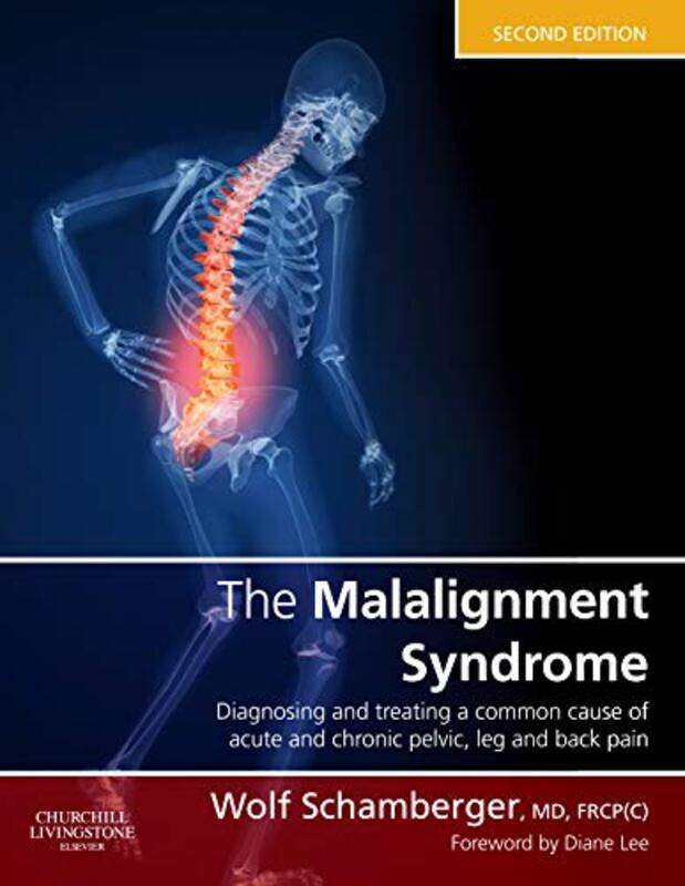 

The Malalignment Syndrome by Anni Kelsey-Hardcover