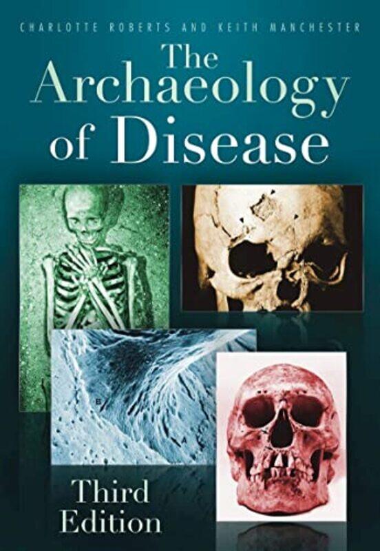 

The Archaeology of Disease by Charlotte RobertsKeith Manchester-Paperback