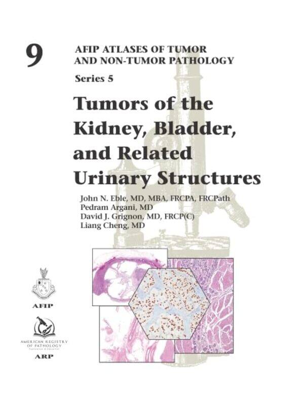 

Tumors of the Kidney Bladder and Related Urinary Structures by Uta Hagen-Hardcover