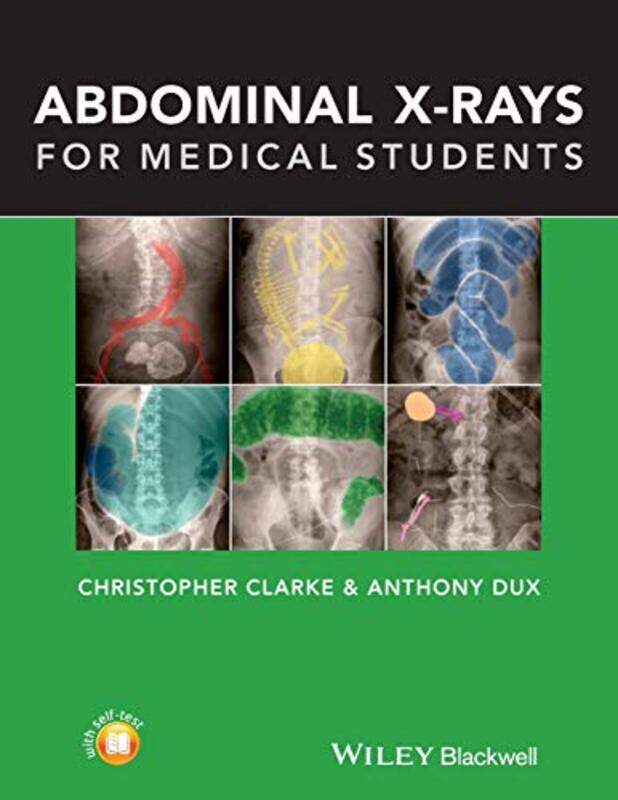 

Abdominal Xrays For Medical Students by Clarke, Christopher -Paperback