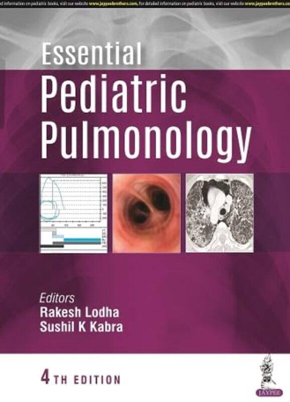 

Essential Pediatric Pulmonology by Isabel CoimbraOlga Mata Coimbra-Paperback