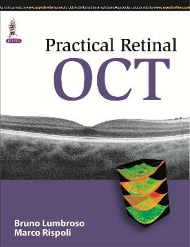 Practical Retinal OCT,Paperback,ByLumbroso, Bruno - Rispoli, Marco