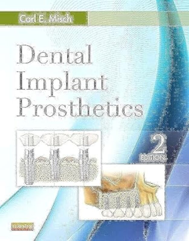 Dental Implant Prosthetics