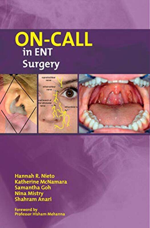 

On-Call in ENT Surgery , Paperback by Nieto, Hannah - McNamara, Katherine - Goh, Samantha - Mistry, Nina - Anari, Shahram