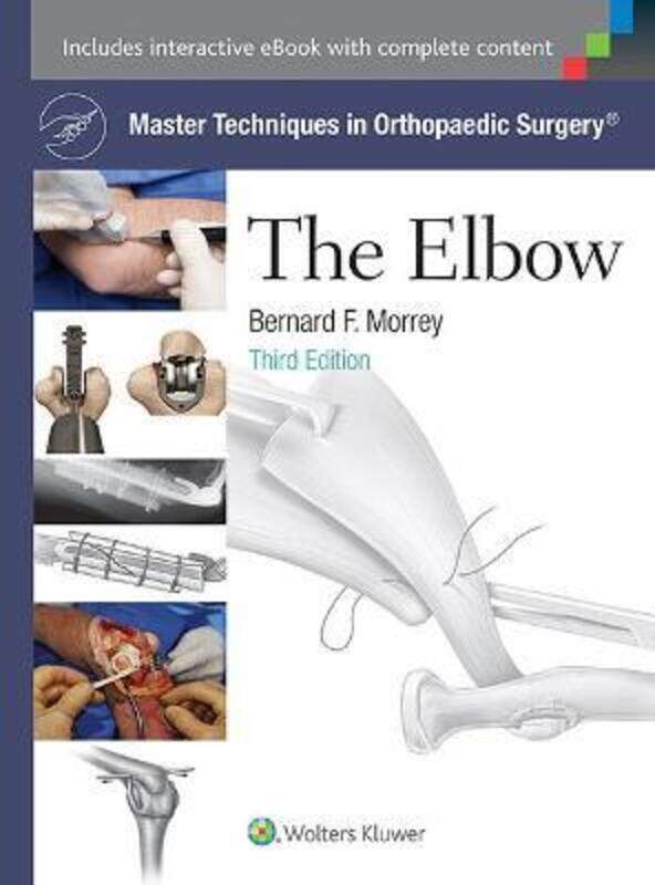 

Master Techniques in Orthopaedic Surgery: The Elbow.Hardcover,By :Morrey, Bernard F., MD