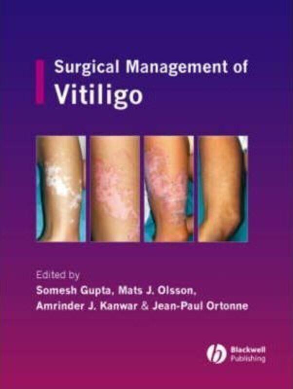 

Surgical Management of Vitiligo.Hardcover,By :Gupta, Somesh - Olsson, Dr. Mats J. - Kanwar, Amrinder J. - Ortonne, Jean-Paul