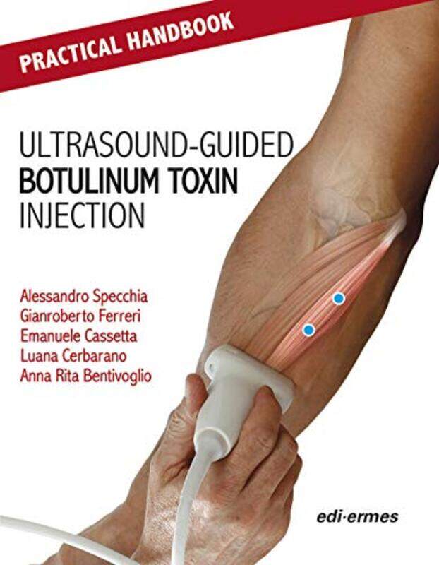 

Practical Handbook for Ultrasoundguided Botulinum Toxin Injection by Alessandro SpecchiaGianroberto FerreriEmanuele CassettaLuana CerbaranoAnna Rita B