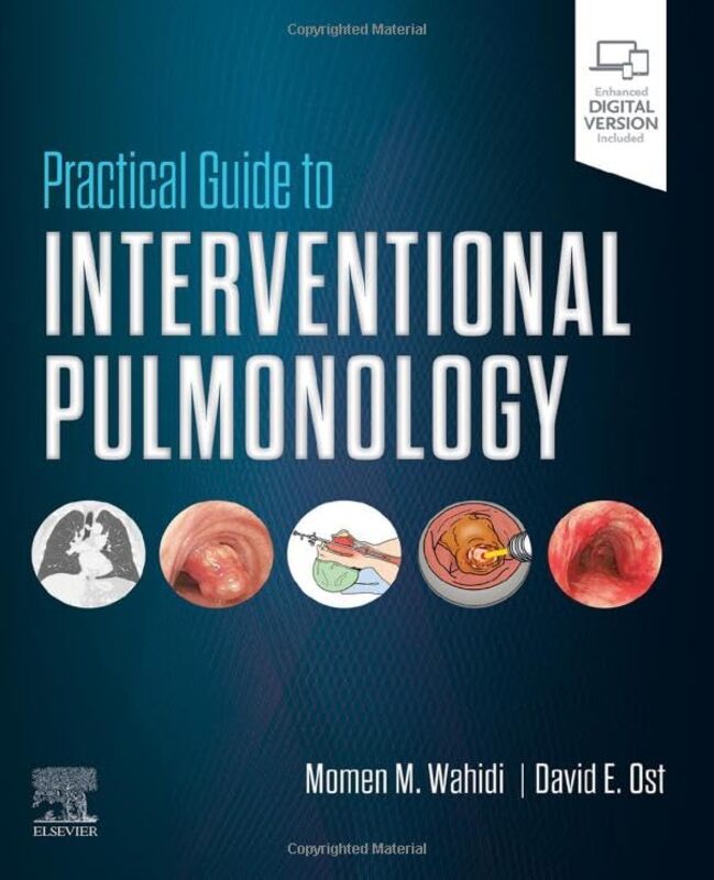 

Practical Guide to Interventional Pulmonology by William Anthony-Hardcover