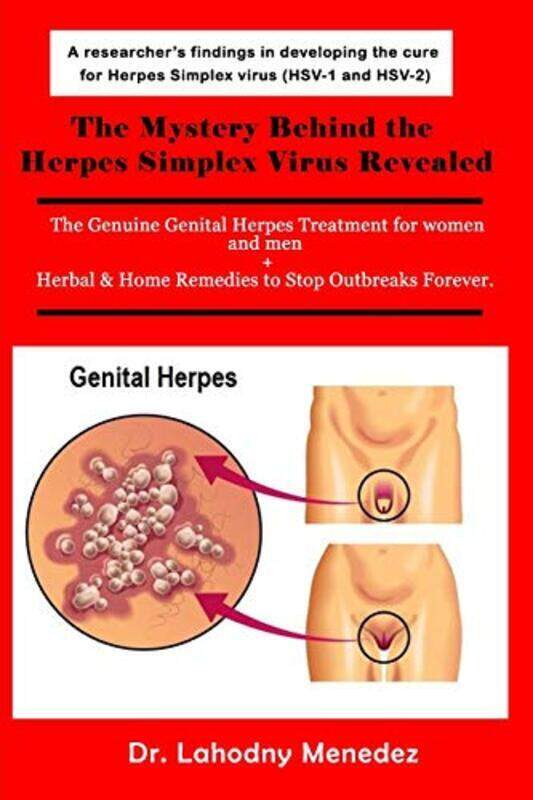 

Mystery Behind the Herpes Simplex Virus Revealed , Paperback by Lahodny Menedez