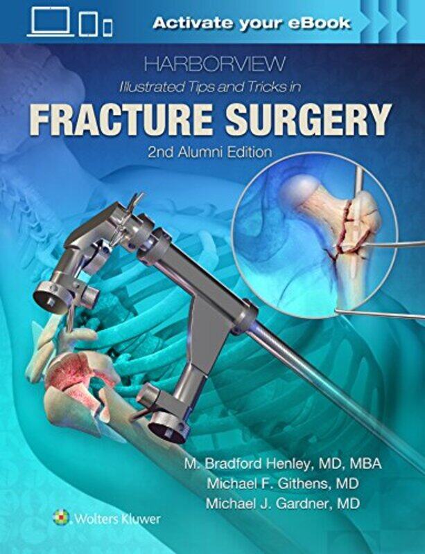 

Harborview Illustrated Tips and Tricks in Fracture Surgery by Candace SavageRachel Wada-Hardcover